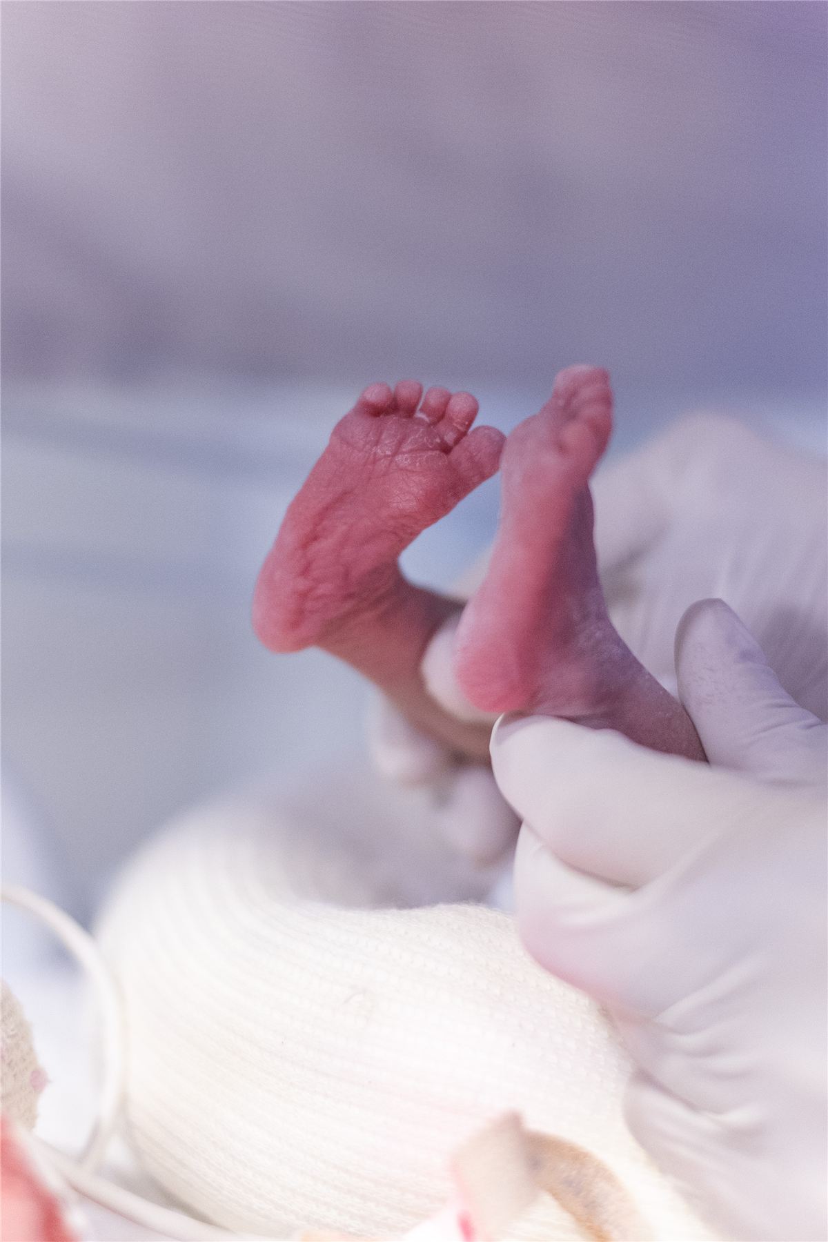 Pezinhos de um bebê prematuro